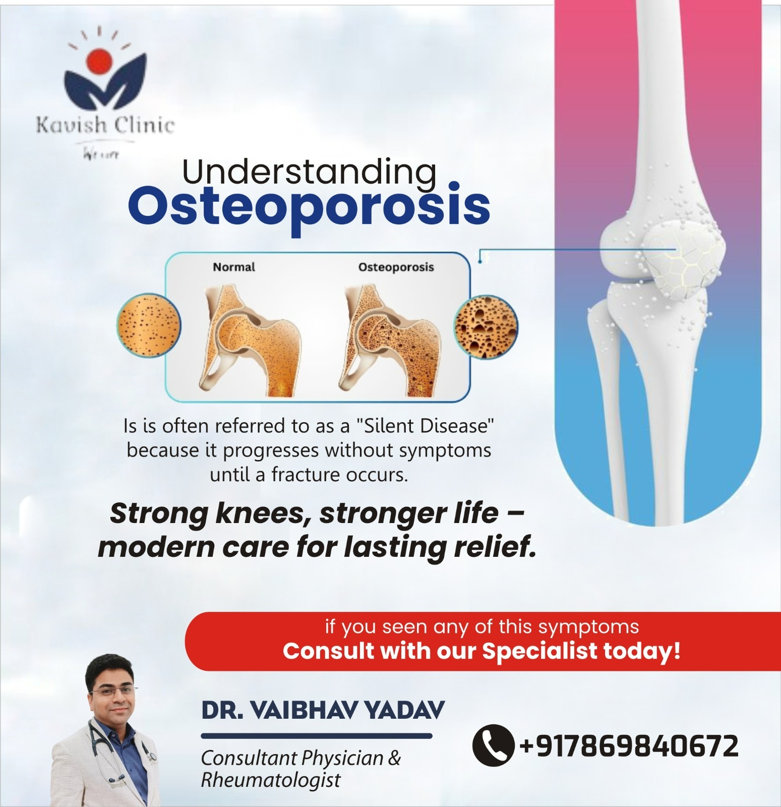 Best Osteoporosis Specialist in Indore
